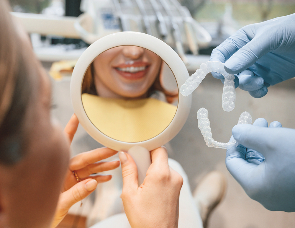 Clear aligners